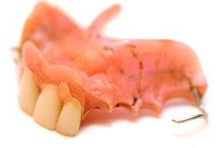 Photo of denture with some of the teeth missing